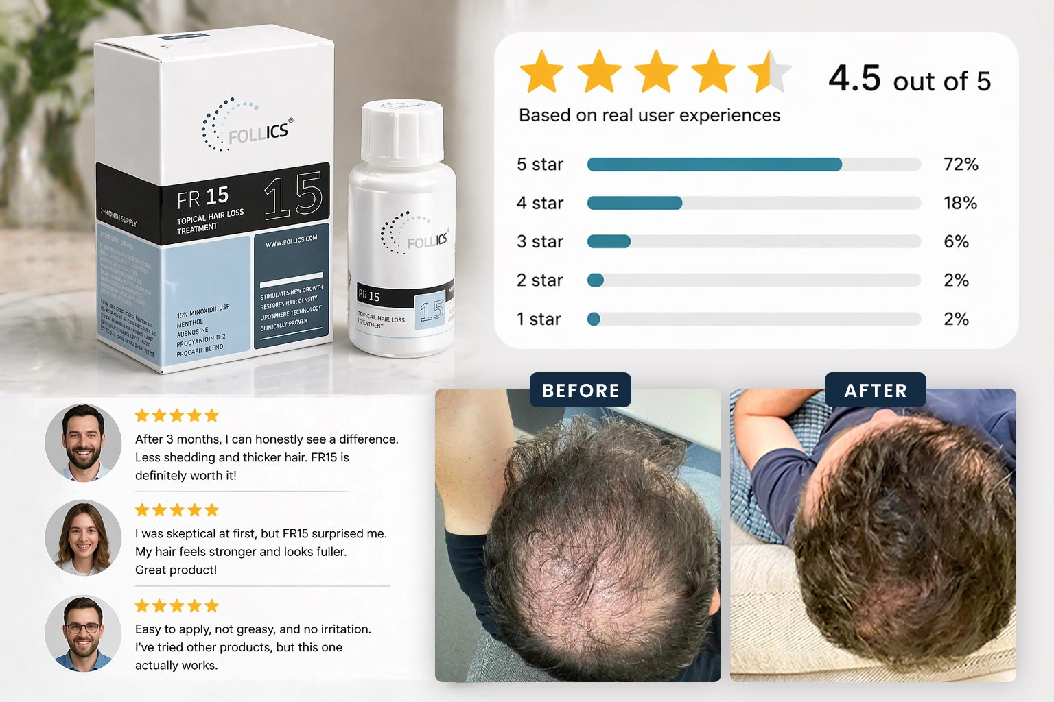 Follics FR15 Review: Is 15% Minoxidil the Ultimate Solution? 3 Follics FR15 Review User Testimonials Before and After