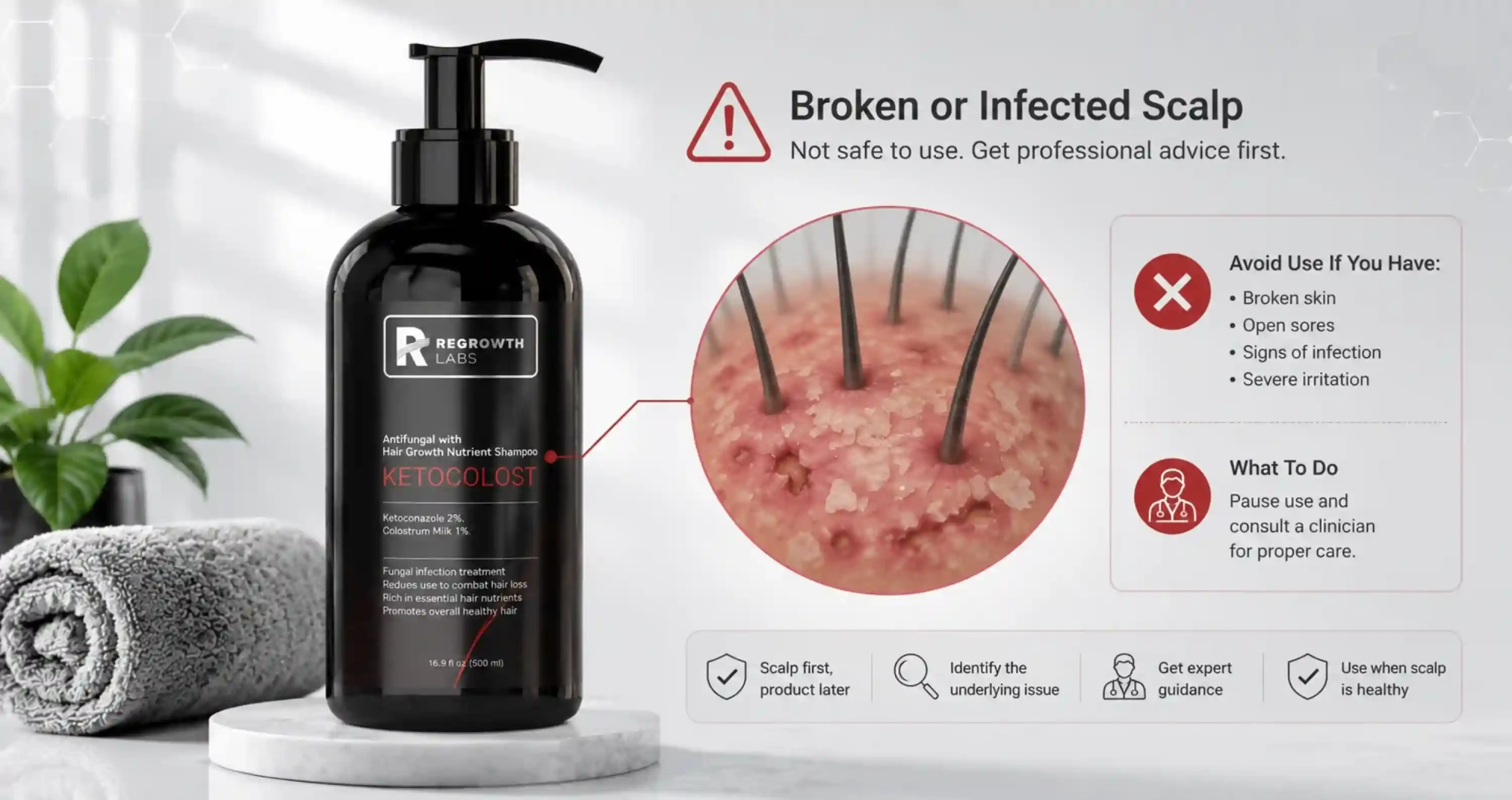 Ketocolost for Sweaty Scalp UAE: Managing Buildup in Heat and Humidity 1 Ketocolost for sweaty scalp UAE